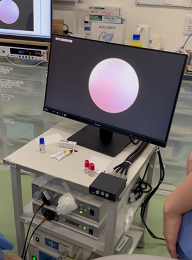 イメージ：涙道内視鏡による鼻涙管閉塞治療