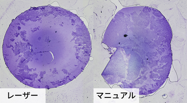イメージ：前嚢切開マニュアルとレーザー比較