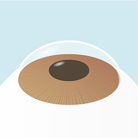 イメージ：手術の流れ4