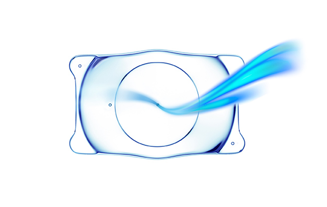 イメージ：眼内コンタクトレンズ