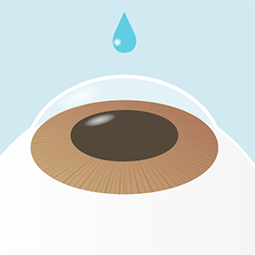 イメージ：手術の流れ1