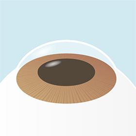 イメージ：手術の流れ6