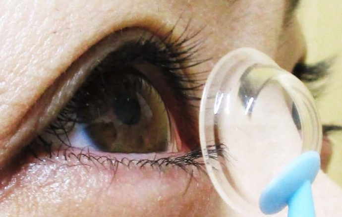 イメージ：スクレラルレンズ