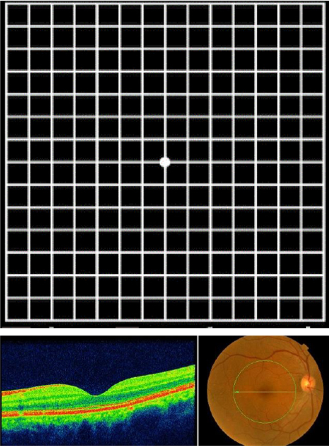イメージ：正常眼