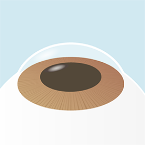 イメージ：手術の流れ1