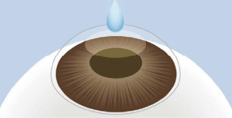 イメージ：点眼麻酔