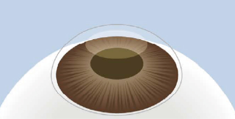 イメージ：自然治癒を待つ