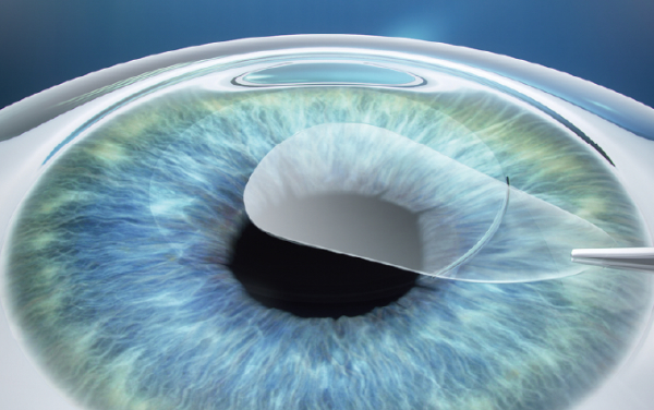 イメージ：低い合併症率